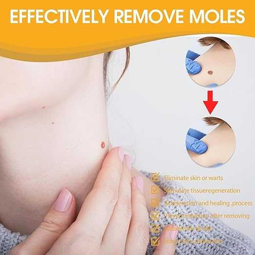 بخاخ إصلاح لدغات النحل - تاغ ريسيدي